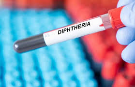 Edo Diphtheria outbreak